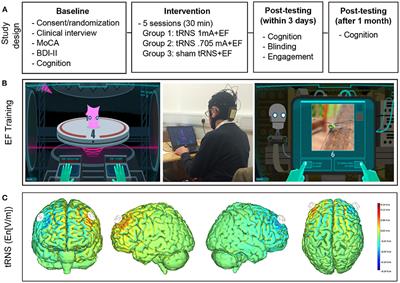 The Effect of Transcranial Random Noise Stimulation on Cognitive Training Outcome in Healthy Aging